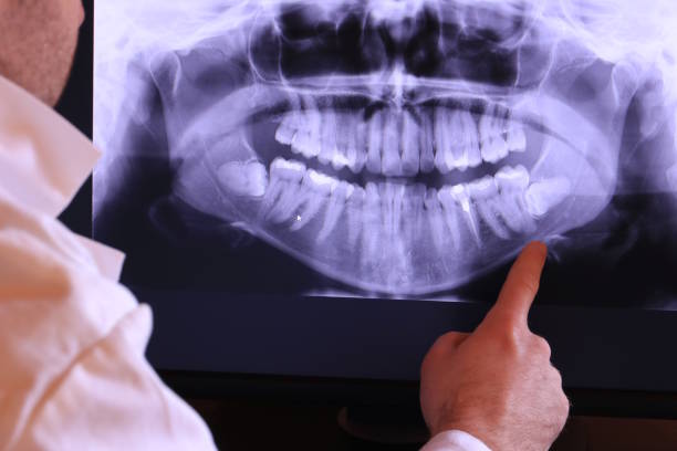 Best Cracked Tooth Emergency Dentist  in Satsuma, AL